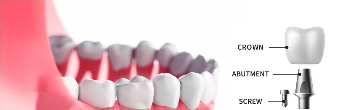 Tcare dental's Store