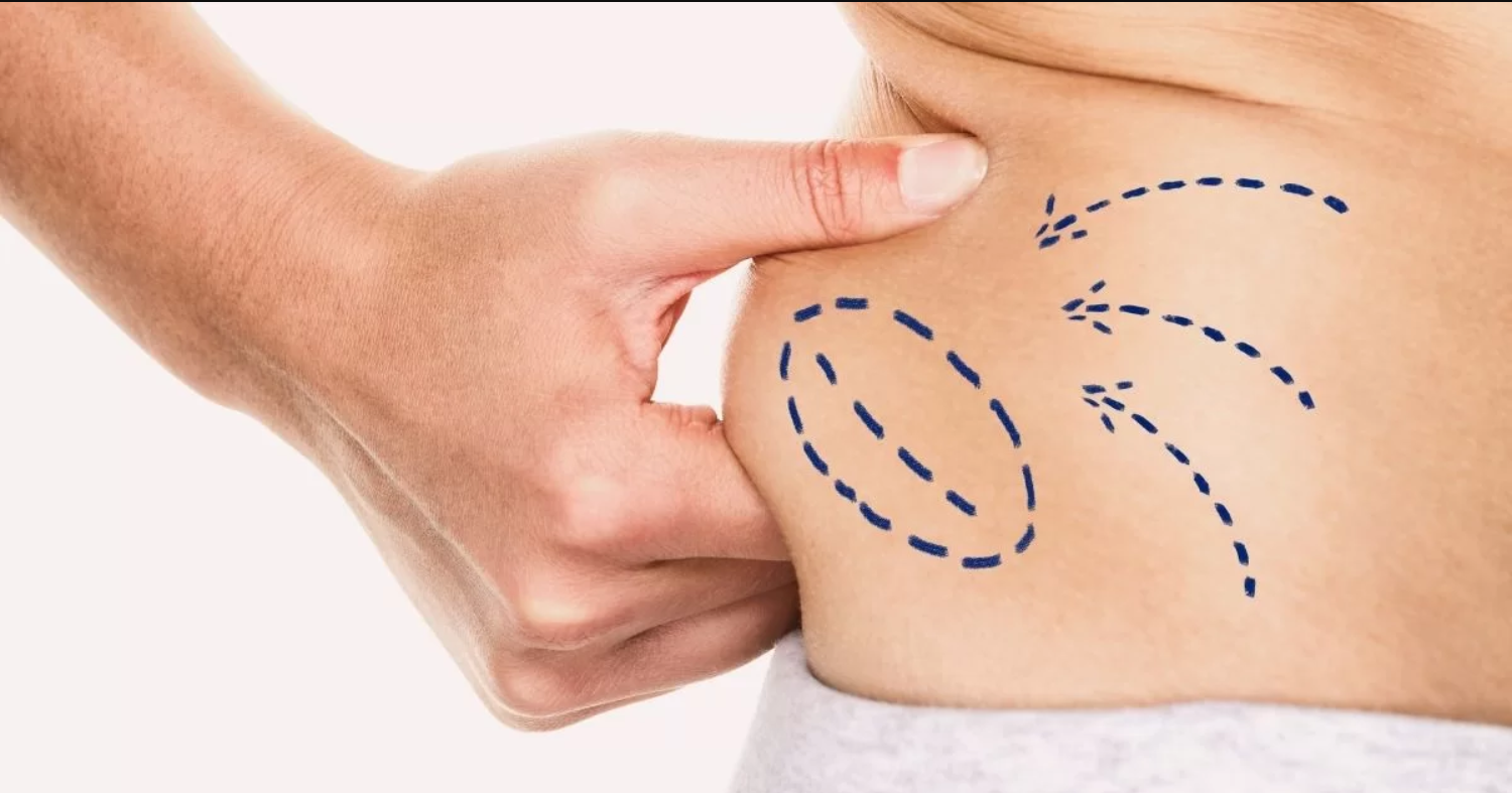 Liposuction Dubai's Store
